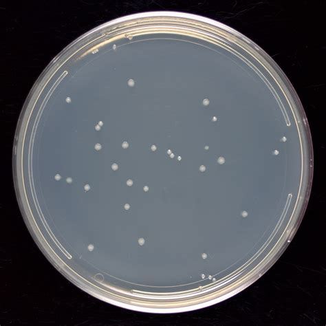 isolated colonies on agar plate